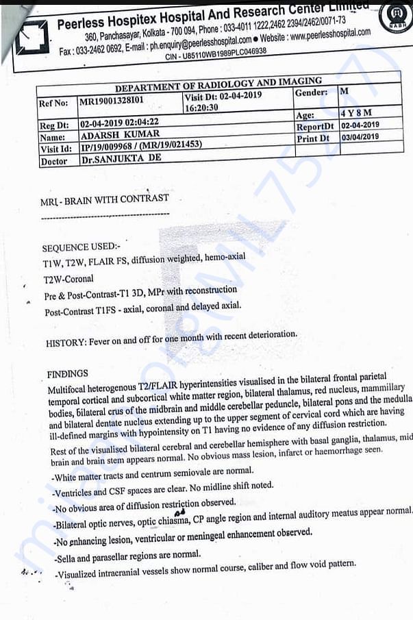 MRI REPORT OF BRAIN OF ADARSH