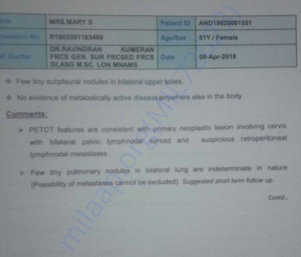 PT CT SACN 2