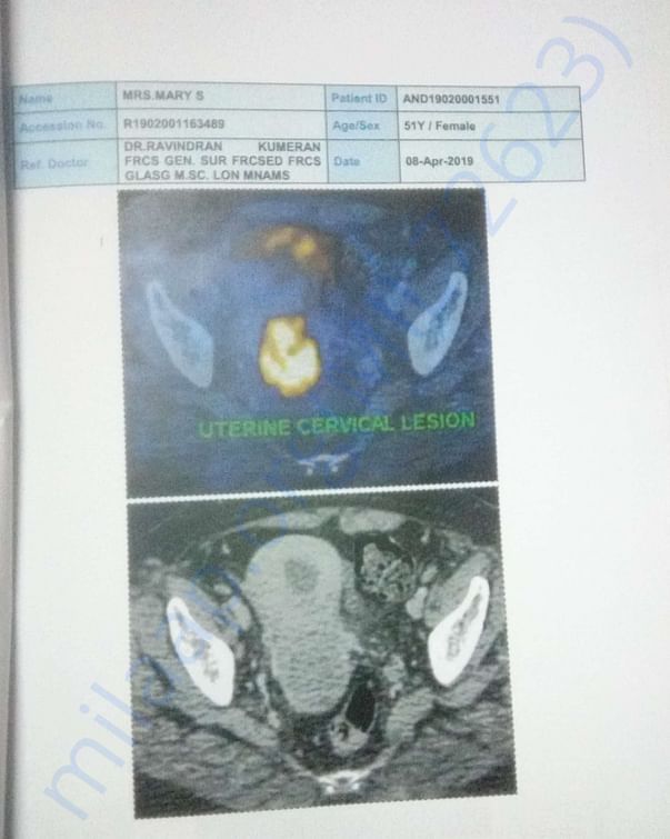 PET Scan images 1