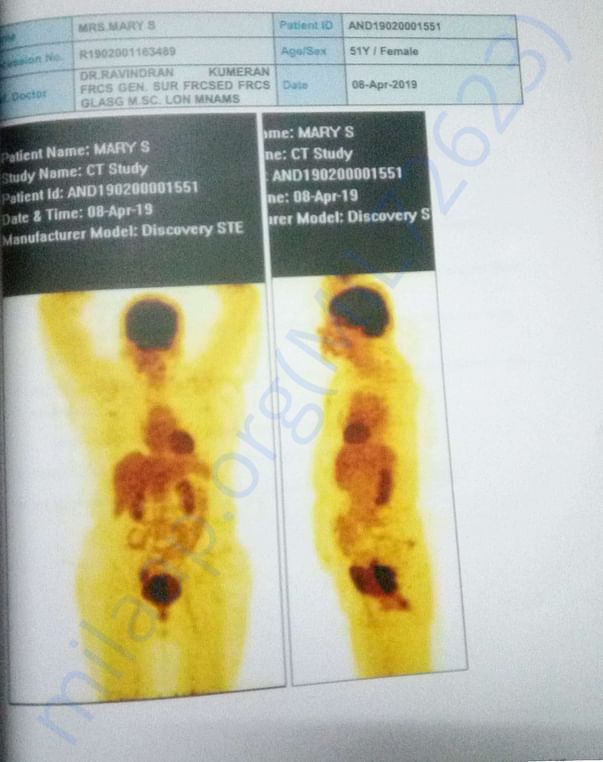 PT CT Scan 4