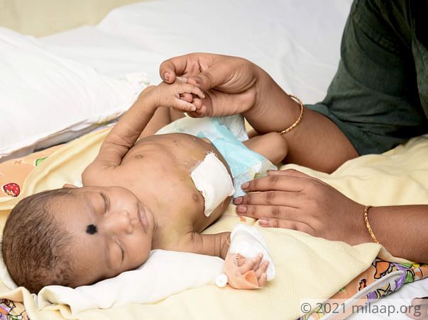 Bhargavi needs your help to undegro her treatment