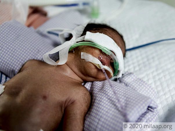 Baby of Arshiya needs your help to survive