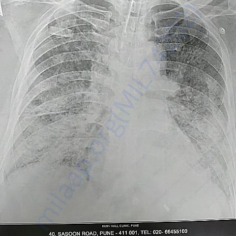Medical Report