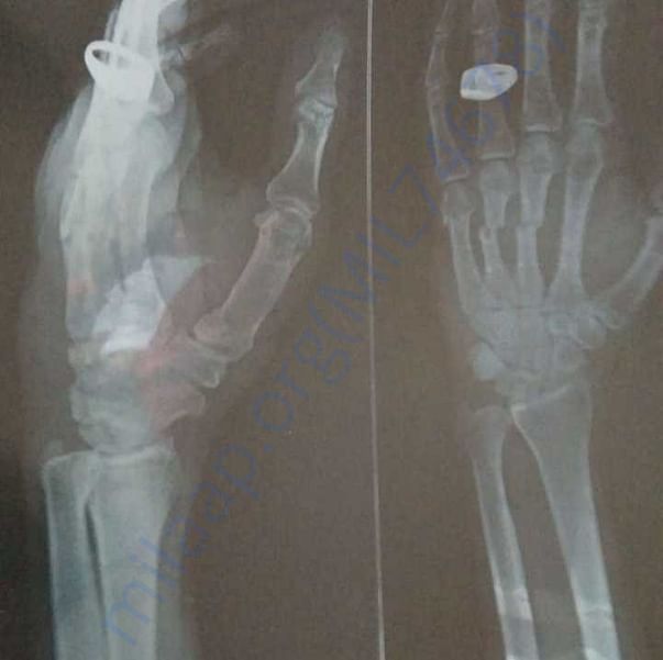 Medical Report