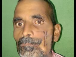 Kamlesh Kirar figting with Cancer please support him