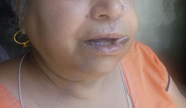 My mother condition