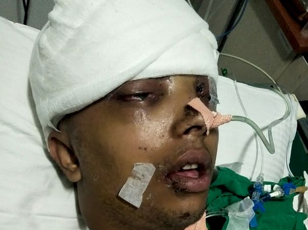 Help Mahesh Recover From A Major Accident