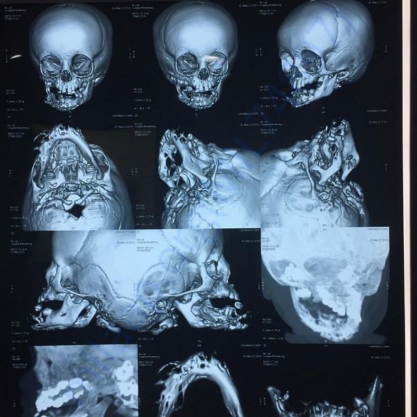 Medical Report