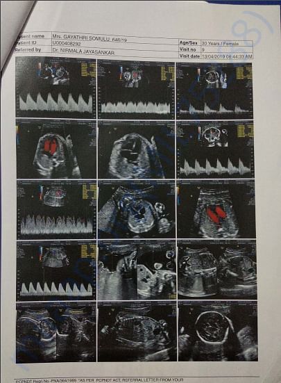 Hospital Report.