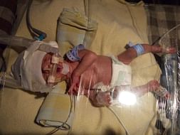 Help My Premature Twin Babies