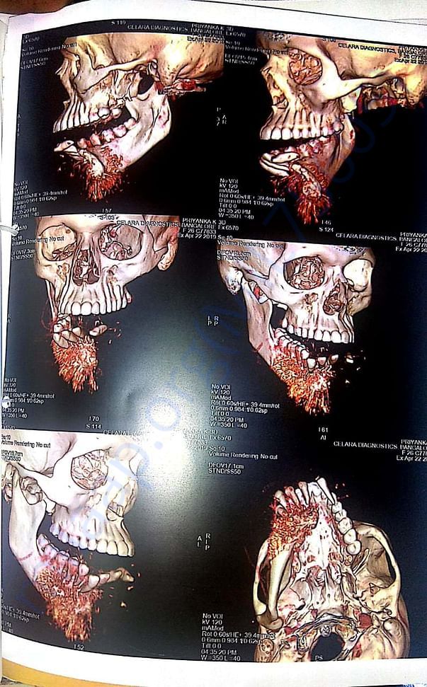 scan