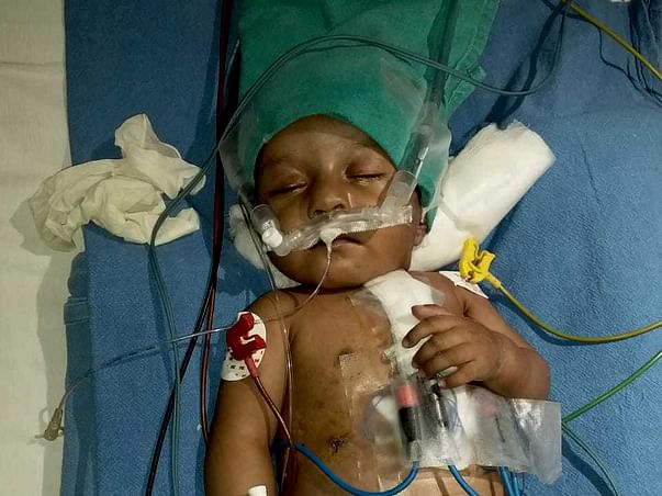 Help Baby Sudeep Kumar Pandey