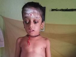 Help Ananth Undergo Bone Marrow Transplant