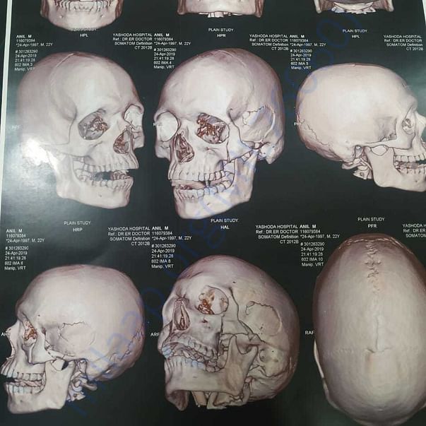 Medical Report