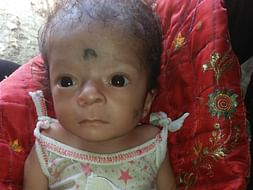 Help 3 Months Rounak To Undergo Heart Surgery