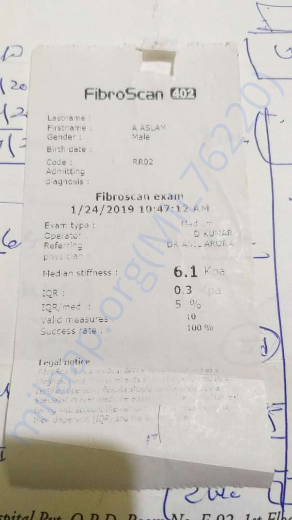 Fibro Scan