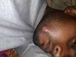 Help Prabhakar Fight Mouth Cancer