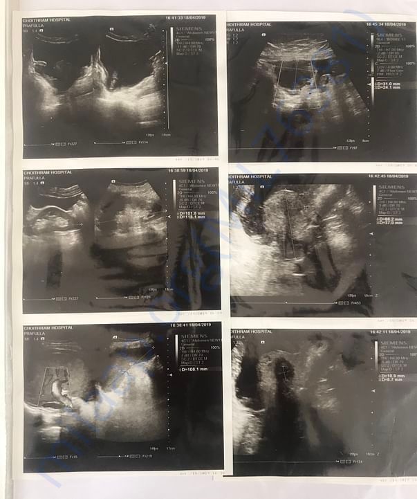 Sonography