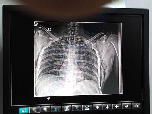 Xray report.