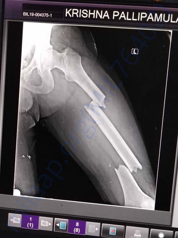 Xray report