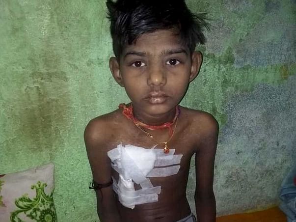 Help Gaurav undergo Kidney Transplant