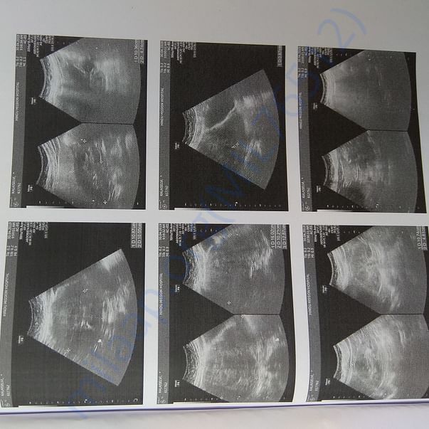 Medical Report