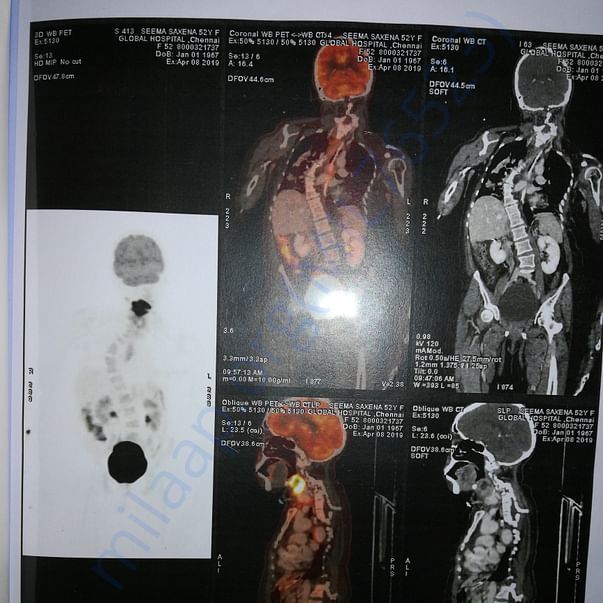 Medical Report