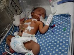 Help This Baby From Aspiration Syndrome