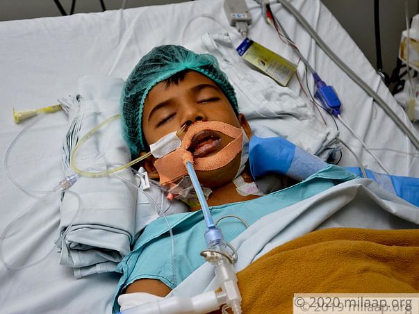 Help Manish Fight Liver Problem