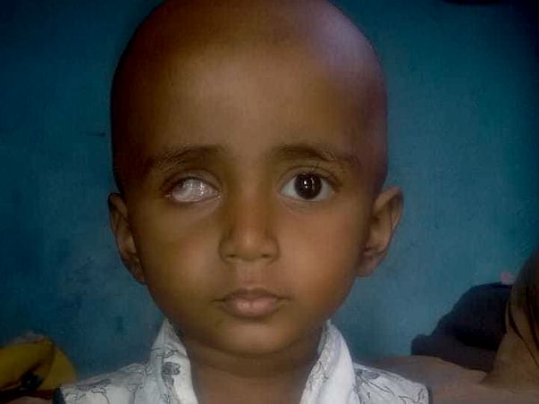 Help Divya Fight Eye Cancer