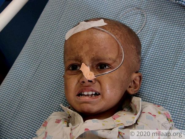 Akshar Patolla needs your help to undergo his treatment
