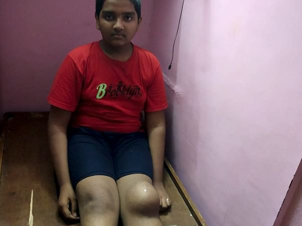 Help Aditya Fight Recurrent ABC Patella