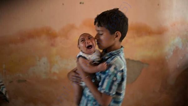 Zika virus