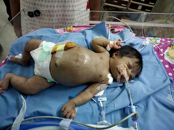 Baby of Sharadha Gowthaman needs your help to survive
