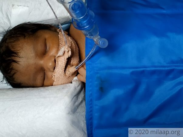 Baby of Parvathi needs your help to survive