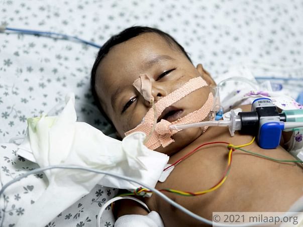 Jasvin Nagineni is in the ICU and need your help to survive