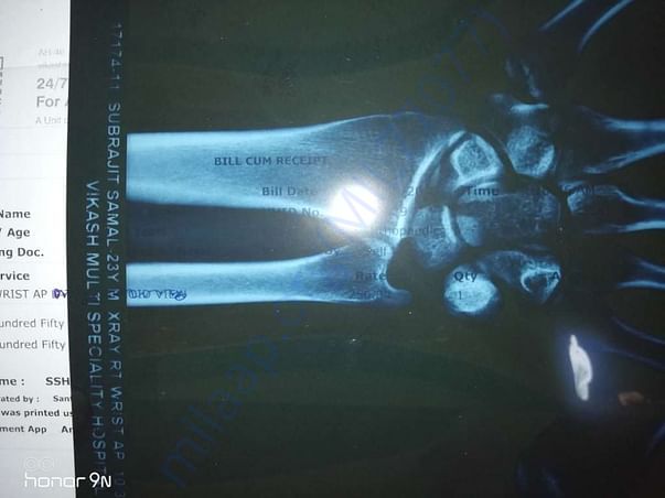 Xray report.