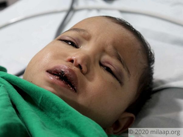 Help Gauri Fight Acute Myeloid Leukemia