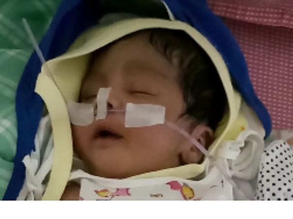 Dharshan fighting for breathing due to Critical Lungs problem