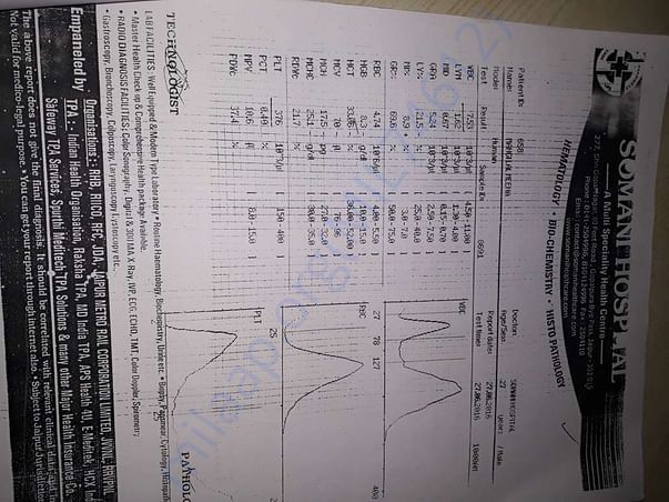 Treatment 3
