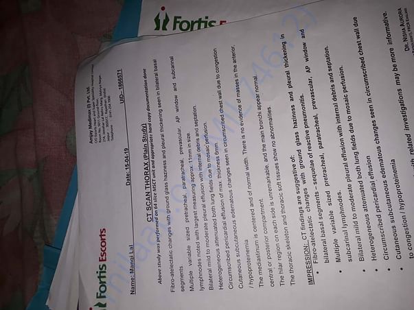 Treatment 15