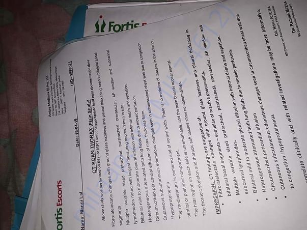 Treatment 14