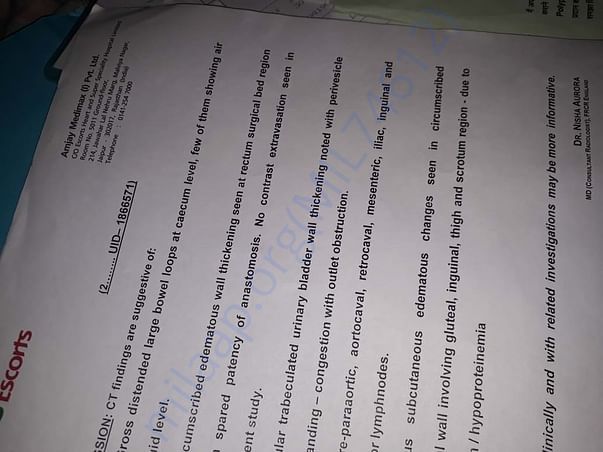 Treatment 13