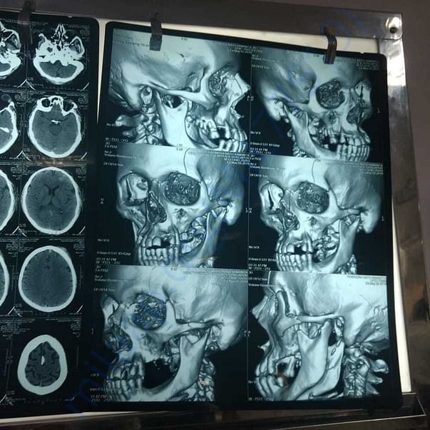 Medical Report