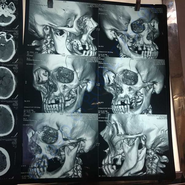 Medical Report