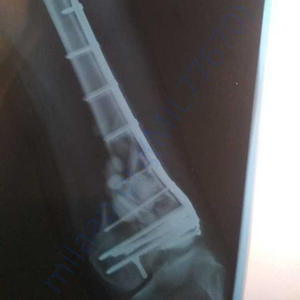 Medical Report