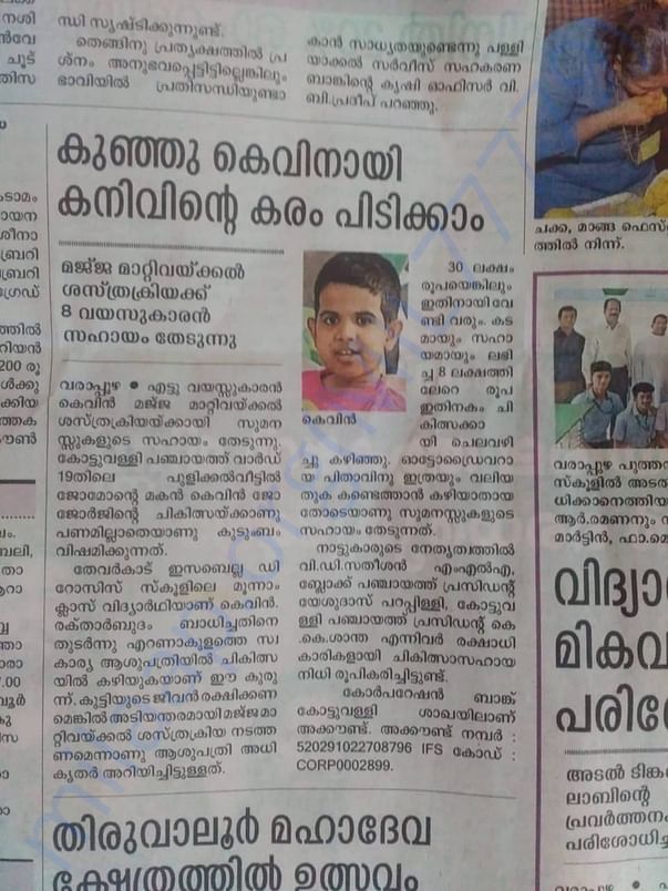 Article about Kevins's Surgery in malayalam daily newspaper - 1