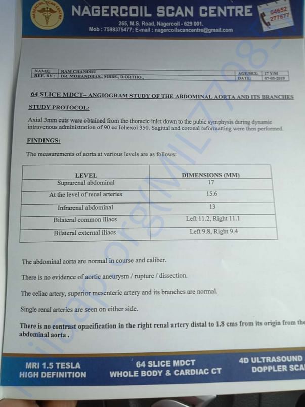 CT Scan Report