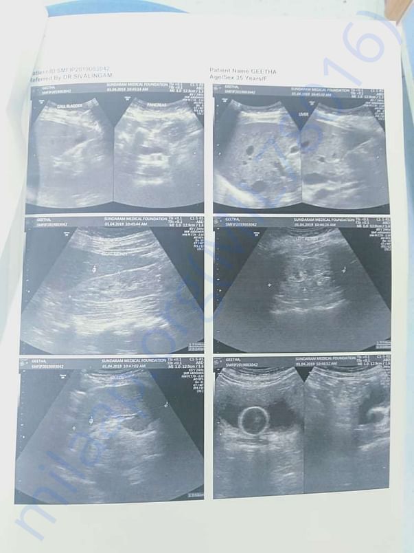 Xray report.