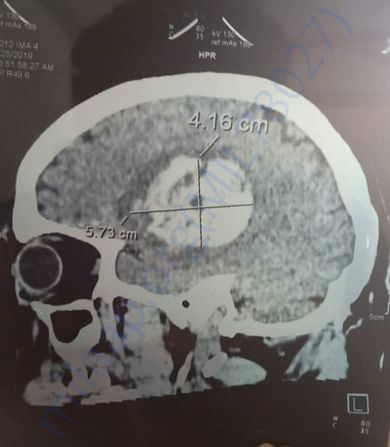 Scan report.
